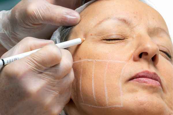 CryoPen: 5 Skin Concerns It May Be Used to Treat 4 What should you ask before having CryoPen treatment Barton-le-Clay?