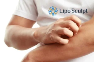 Best Actinic Keratoses Removal 4 prevent your actinic keratoses Barton-le-Clay getting worse - call our team today!