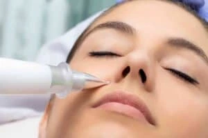 Best Actinic Keratoses Removal 3 Actinic keratoses Barton-le-Clay solutions - book in today!